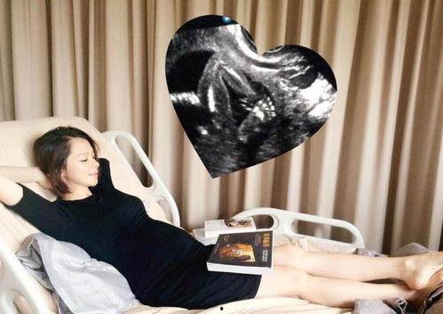 保胎的明星,孕期明星们的育儿智慧与经验分享